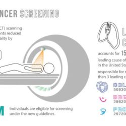 Lung cancer hesi case study