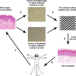 Autologous vs nonautologous tissue substitute