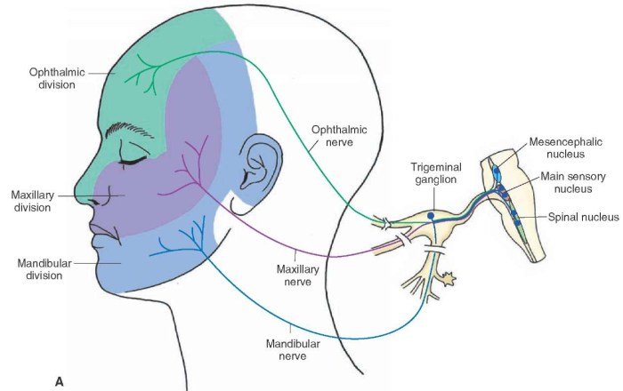 Migraine headaches and trigeminal neuralgia are examples of _____.